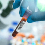 Kanser teşhis testleri sigortacılar için fırsat mı?