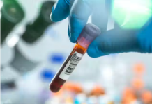 Kanser teşhis testleri sigortacılar için fırsat mı?